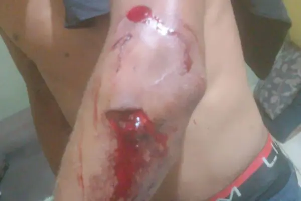 Foto: Divulgação